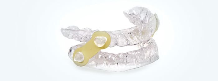 EMA (Elastic Mandibular Advancement Appliance)